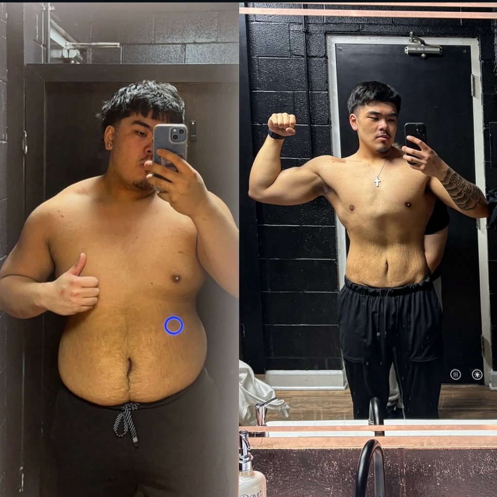 Tyler before and after losing more than 95 pounds